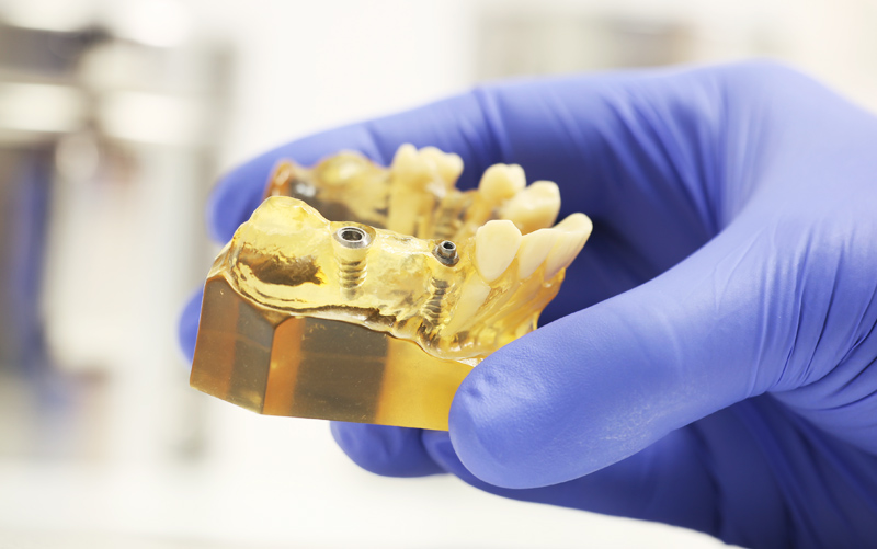 dentale Implantologie